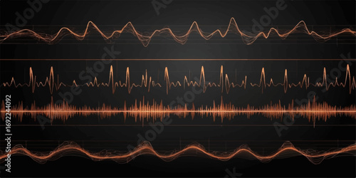 A continuous EKG heartbeat pulse wave on a green cardiogram monitor screen