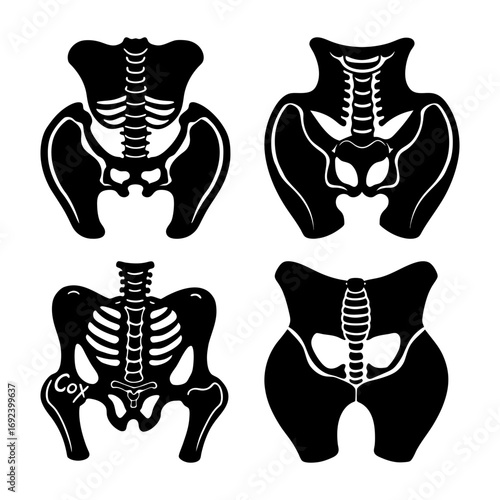 Anatomical illustration showcasing four distinct pelvic bone structures in a stylized black silhouette