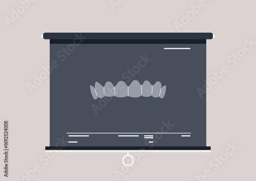 Highlighted on a display board is a detailed x ray showing clear aligners designed for straightening teeth, This presentation emphasizes the intricate process of orthodontic correction