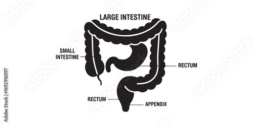 A black and white illustration showing the anatomical structure of the human large intestine, including the cecum, rectum, and appendix, with the stomach also depicted.