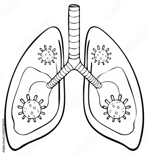 Human Lungs Infected with Coronavirus - Virus Particles Affecting Respiratory System Anatomy, Health and Medical Disease Hand Drawn Illustration