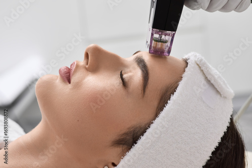 Non-surgical lifting of woman face with help of newest microneedle radio frequency lifting procedure. Rf lifting procedure at beauty parlour