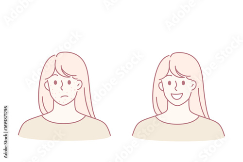 Skin problem and health concept. Stressed unhappy young woman with red acne pimples and smiling with healthy skin face vector illustration