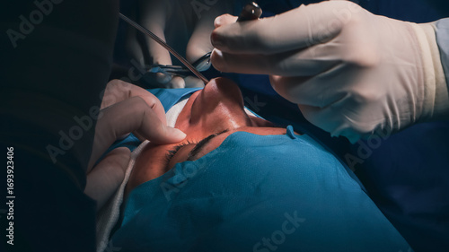 surgeon perform rhinoplasty surgery
