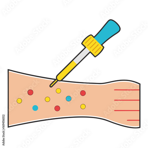 Vector illustration of allergy skin test performing pipette applying droplets on human arm white background