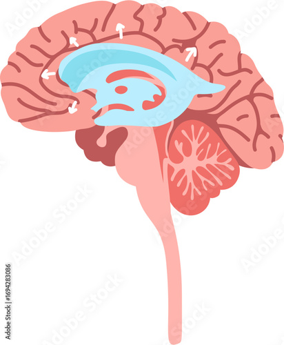 Human Brain Anatomy with Hydrocephalus Condition