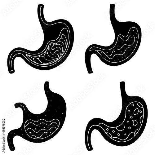 Four anatomical illustrations of human stomachs with varying internal contents in black and white design