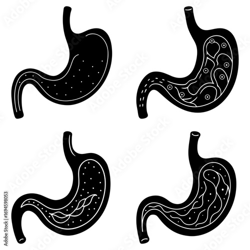 Four stylized black and white stomach diagrams showing different internal structures and conditions of the organ