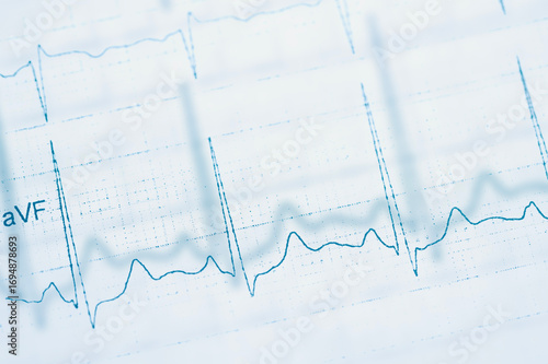 World Heart Rhythm Week concept. Electrocardiogram graph on paper. National Heart Health Month. World Heart Day awareness background.