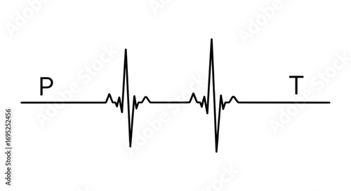 Simplified electrocardiogram showcasing the electrical activity of the heart depicted as a
