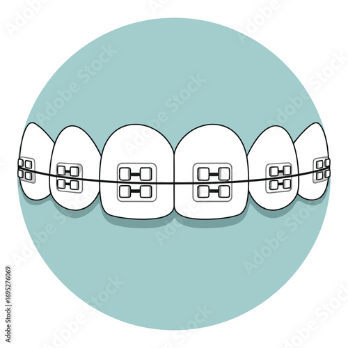Art of closeup of teeth with orthodontic braces, showing metal brackets and wires for dental alignment and correction, isolated on a light blue background