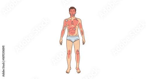 medical illustration man with lesions, skin rashes, and body pain health issues, medical concept