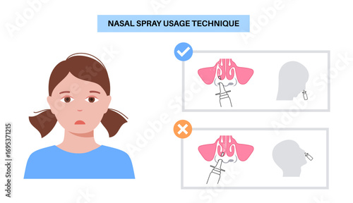 Proper nasal spray usage