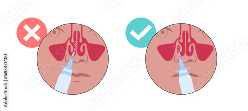 Proper nasal spray usage