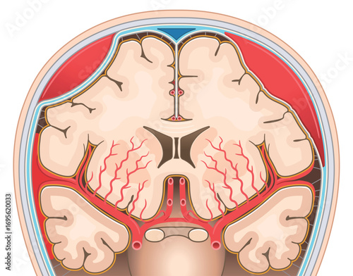 くも膜下出血・硬膜外血腫・硬膜下血腫のイラスト