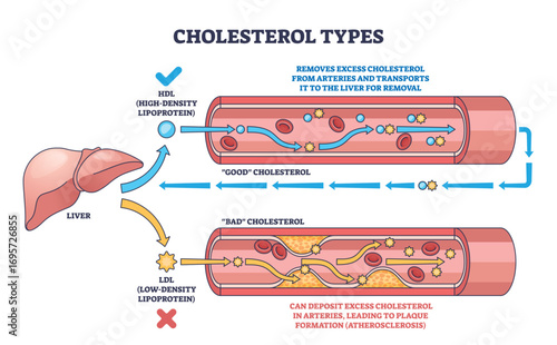 Cholesterol types are shown with HDL and LDL flow in blood vessels, highlighting liver, arteries, and cholesterol particles. Outline diagram