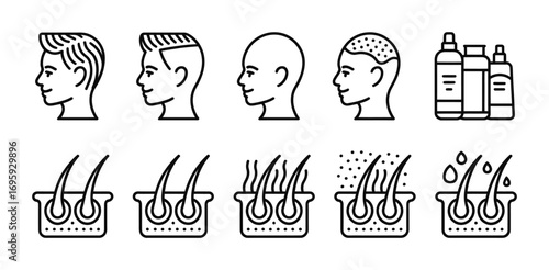 Hair loss treatment alopecia baldness hair growth follicle care shampoo serum hair transplant solution