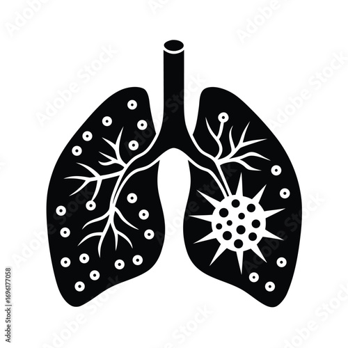 Advanced Stage Lung Cancer Symptoms