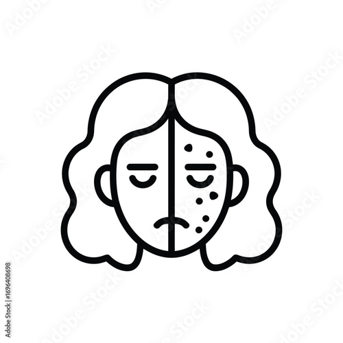 Illustration of a person s face showing skin imperfections on one side
