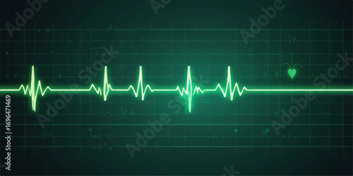 EKG heart beat on monitor, a pulsating medical cardiogram line on an electrocardiogram graph