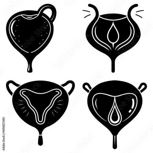 Illustration showing four different bladder shapes and conditions in a black and white drawing style