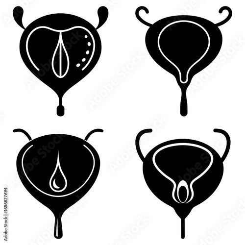 Four bladder illustrations showing different anatomical views in black and white outline style drawing design