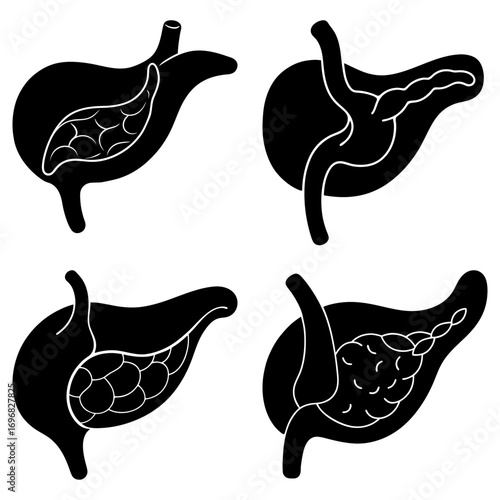 Four anatomical illustrations of the gallbladder and bile ducts in black and white medical diagrams