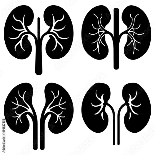Four kidney illustrations in black and white showing different anatomical perspectives and orientations
