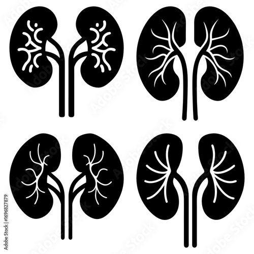 Four kidney illustrations with varying internal structures in black and white medical anatomy diagram style