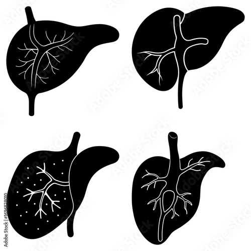 Four black and white liver illustrations showcasing different anatomical structures and variations shown clearly
