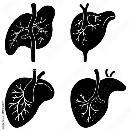Four liver illustrations showcasing anatomical variations in black and white silhouette style image design