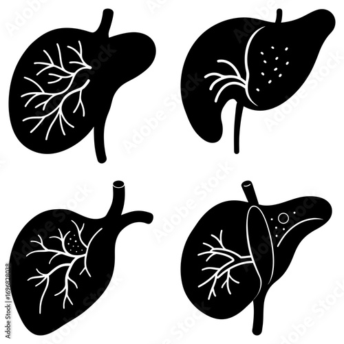 Four black liver illustrations with different internal structures on a white background image display