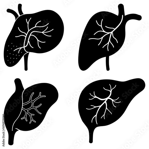 Four liver illustrations with internal vein structures in black and white anatomical medical diagrams