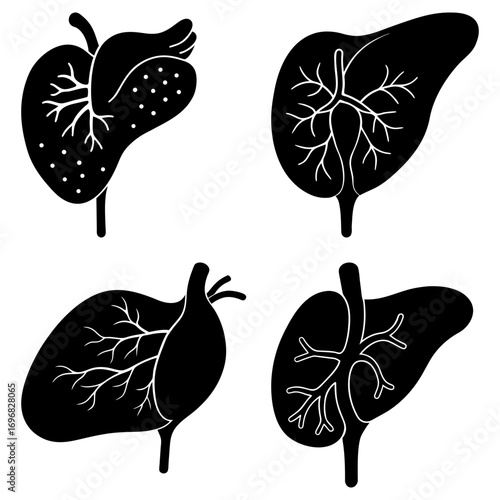 Four black and white anatomical liver illustrations with branching vein structures on a white background