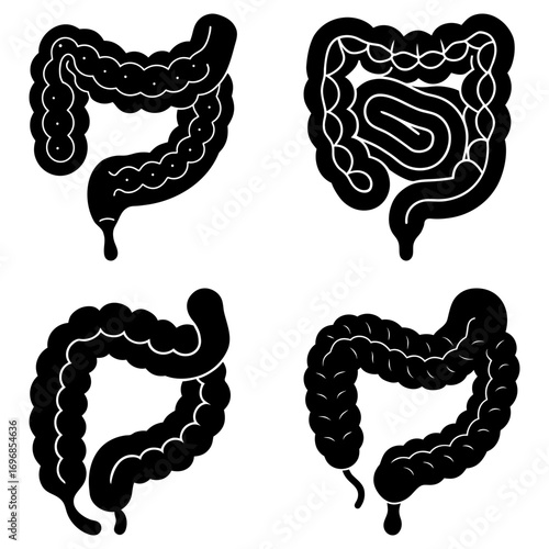 Four black and white illustrations of different colon shapes and configurations on a white background