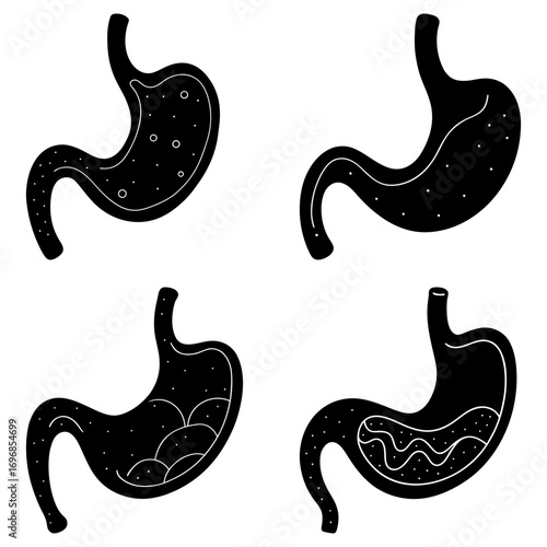 Four black and white stomach illustrations showing different internal contents and conditions depicted clearly