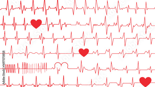 Vibrant red heart shapes pulse with a dynamic electrocardiogram pattern, symbolizing health and life.