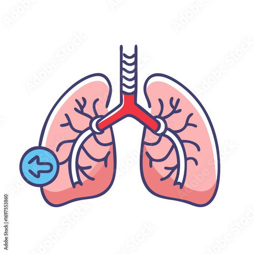 Pulmonary Embolism Illustration Demonstrating Lung Disease and Medical Condition