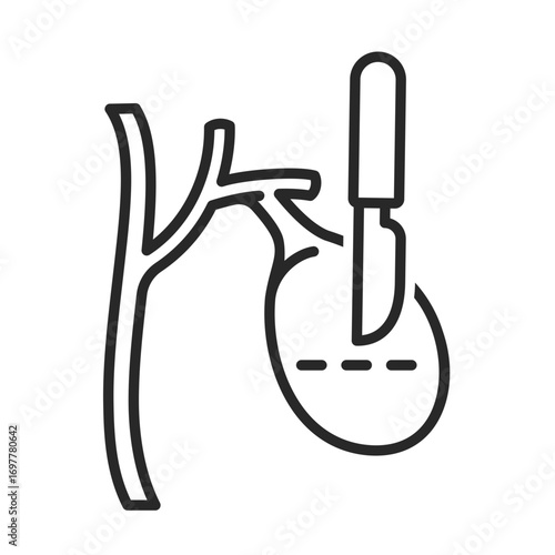 Gallbladder surgery line icon vector for medical and healthcare clip art.