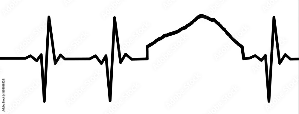 Fototapeta premium Electrocardiogram Waves - Everest
