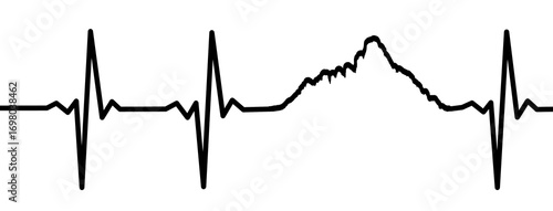 Tableau sur toile Electrocardiogram Waves - Paterno