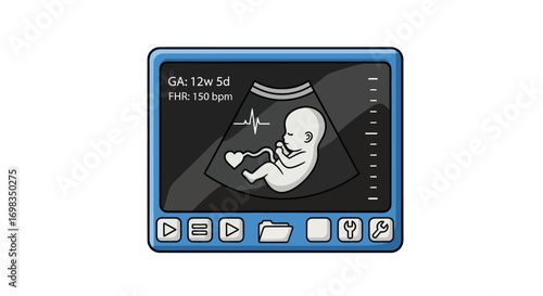 Cartoon Ultrasound Displaying Fetus with Heartbeat and Details.