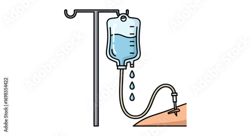 IV Fluid Drip Infusion System for Medical Treatment.