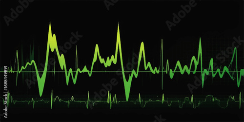 An illustrated medical cardiogram showing the green pulse of a healthy heartbeat on a monitor