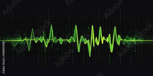 Green electrocardiogram waves show a heart's rhythmic pulse on a medical monitor