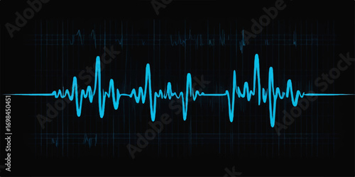 An electrocardiogram, or ECG, displays a patient's heartbeat on a medical monitor as a pulsating cardiogram wave