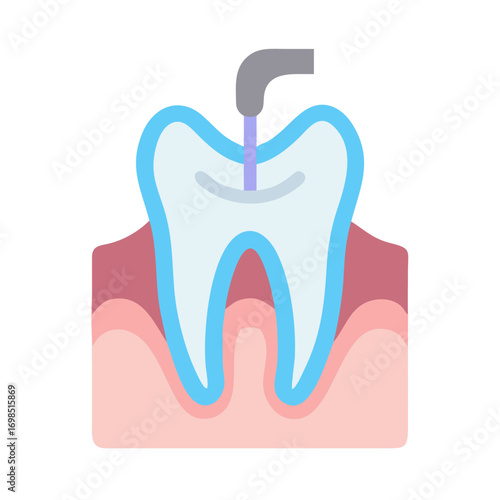 Tooth with root canal treatment flat design illustration