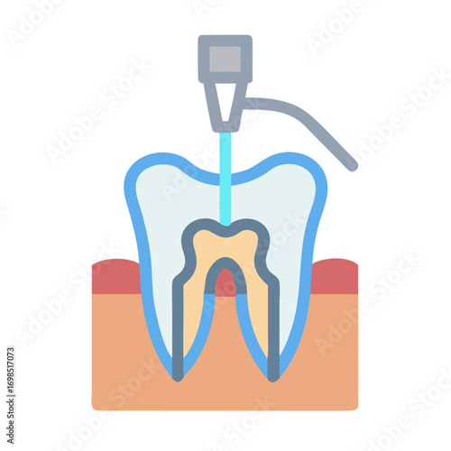 Root canal procedure illustration with flat design on black background