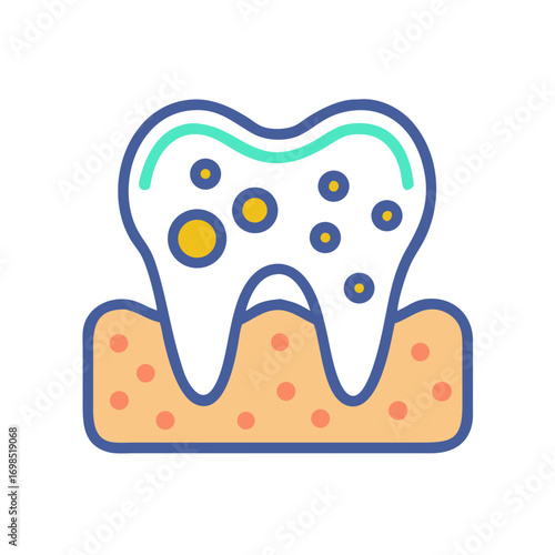 Illustration of a decayed tooth surrounded by gingiva