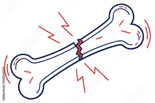 Illustration of a broken bone with red lightning bolts and radiating lines